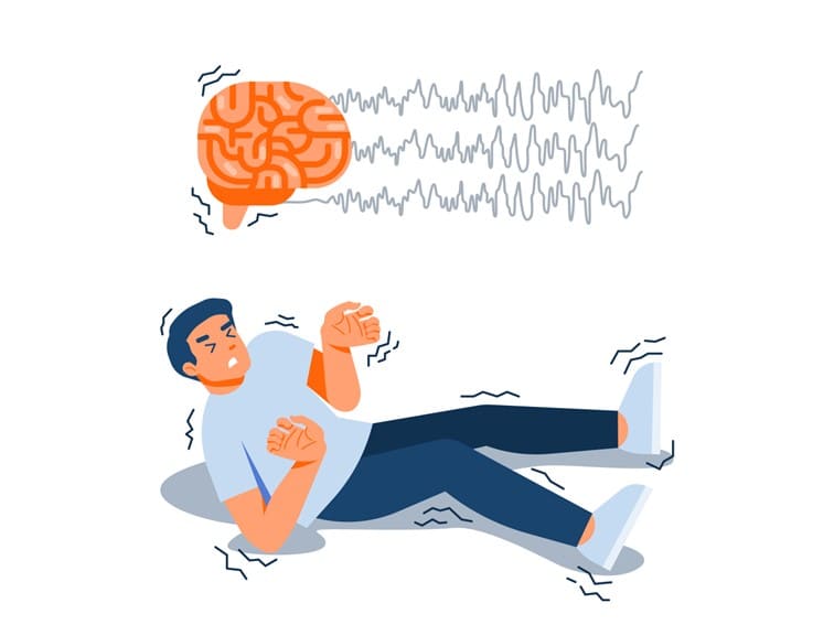Migraine Treatment