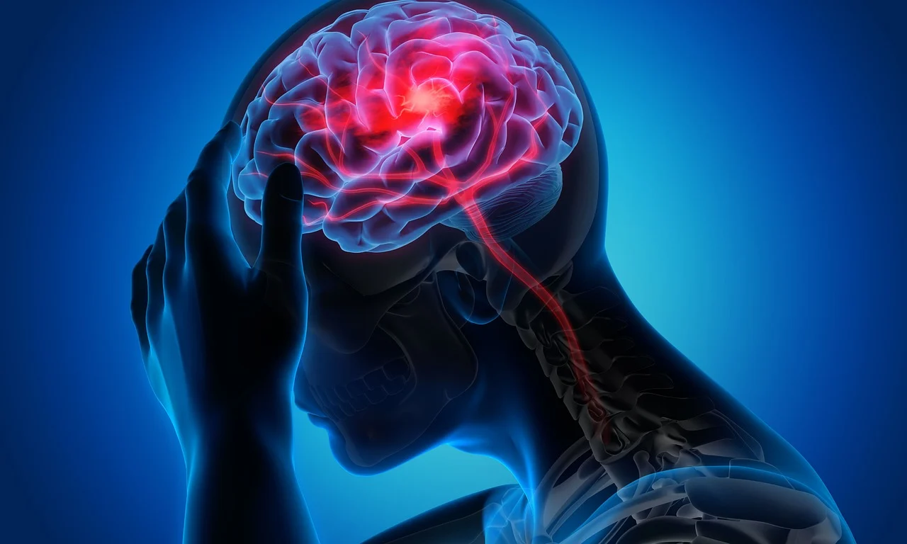 Migraine Treatment