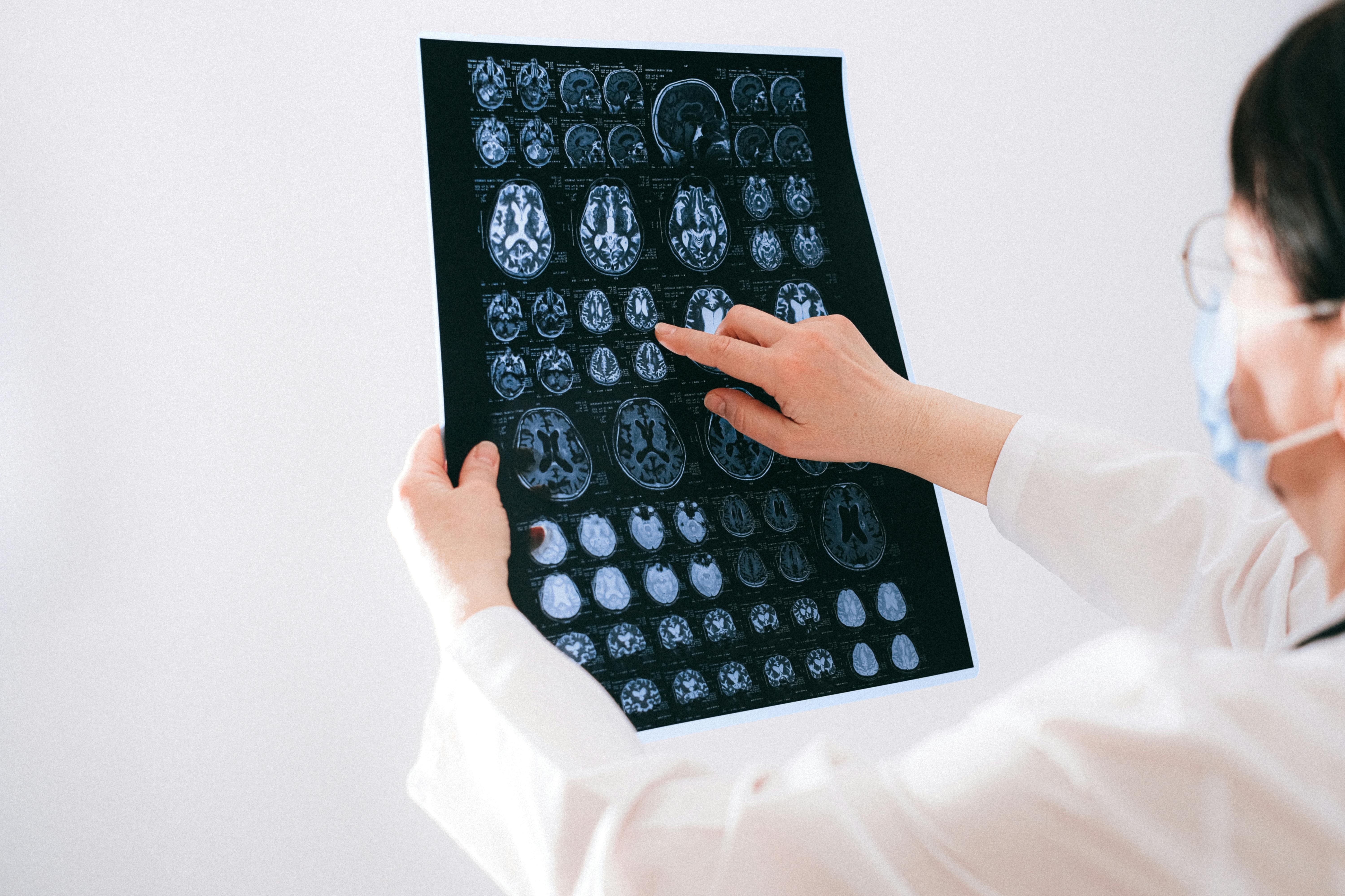 Neurology Care